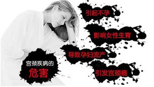 上海供卵不排队_宫颈炎吃什么药?宫颈炎的症状是什么?宫颈炎的危害是什么?