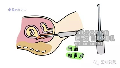 上海金贝供卵中心官网_胎儿发育比实际周数小是怎么回事？很可能是这些原因