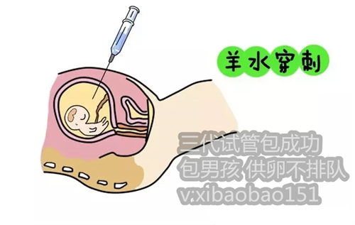上海供卵怀孕_天津代怀代怀机构,女孩子取精子库是什么