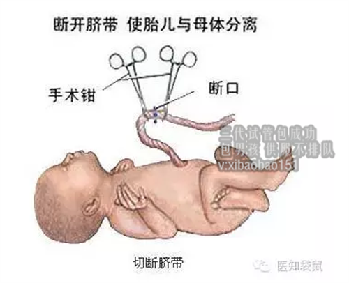 上海代怀哪家好_半月谈丨我国每年约有30万名试管婴儿诞生：走出生殖辅助误区